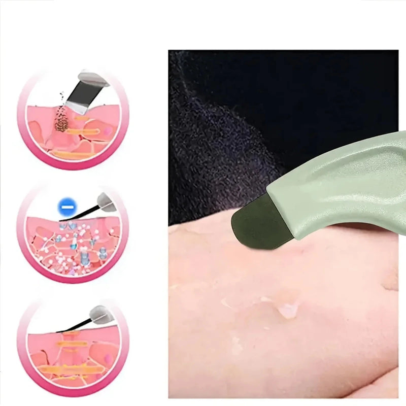 Limpa Cravo | ClearGlow  | Limpeza Profunda - Sem Esforço