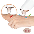 Removedor de Cravos | SilkTouch - Portátil + Removedor Manual